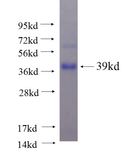 Recombinant human TST SDS-PAGE