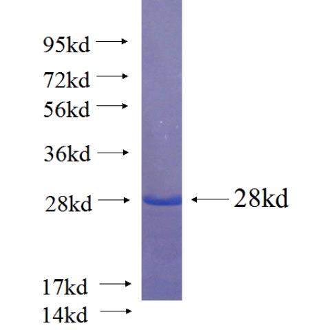Recombinant human FOXP3 SDS-PAGE