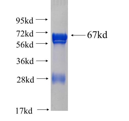 Recombinant human DDO(Full length) SDS-PAGE