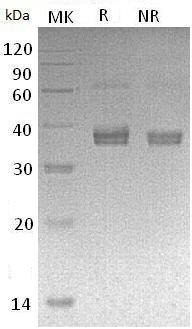 Human ADAMDEC1 (His tag) recombinant protein