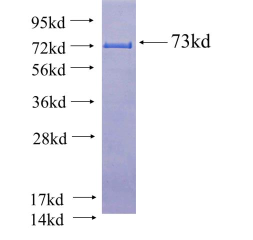 Recombinant human EIF4A3(Full length) SDS-PAGE