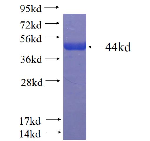 Recombinant human METTL3 SDS-PAGE