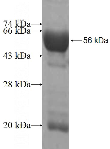 Recombinant Human DHRS4 SDS-PAGE