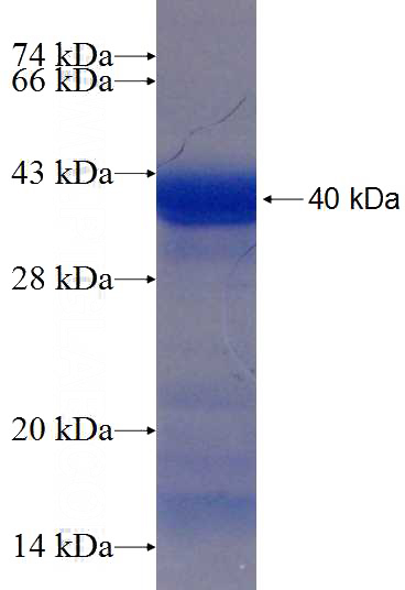 Recombinant Human PPP2R3C SDS-PAGE