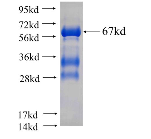Recombinant human SH3GLB1(Full length) SDS-PAGE