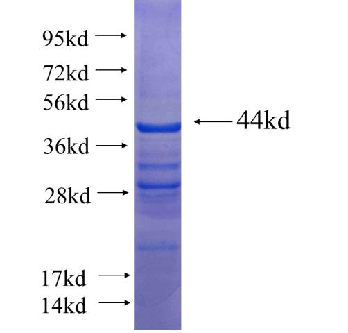Recombinant human C1orf92 SDS-PAGE