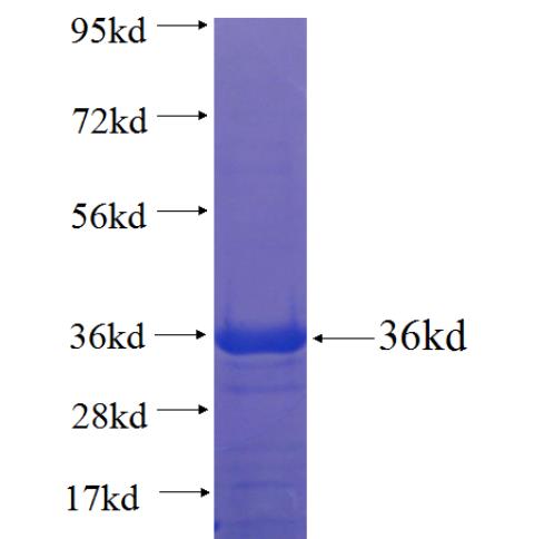 Recombinant human TBX15 SDS-PAGE