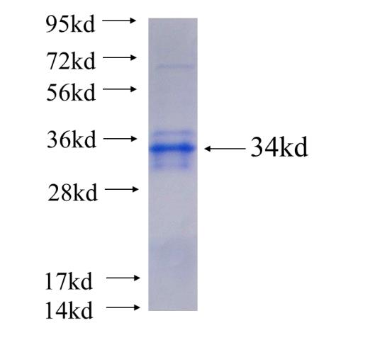 Recombinant human CEP290 SDS-PAGE