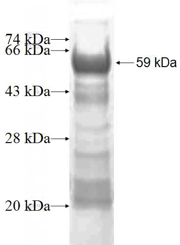 Recombinant Human PHYHD1 SDS-PAGE