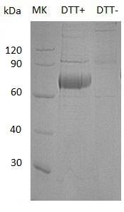 Human OLFM4/GW112/UNQ362/PRO698 (His tag) recombinant protein