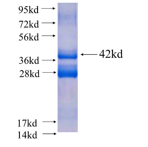 Recombinant human CCDC25 SDS-PAGE