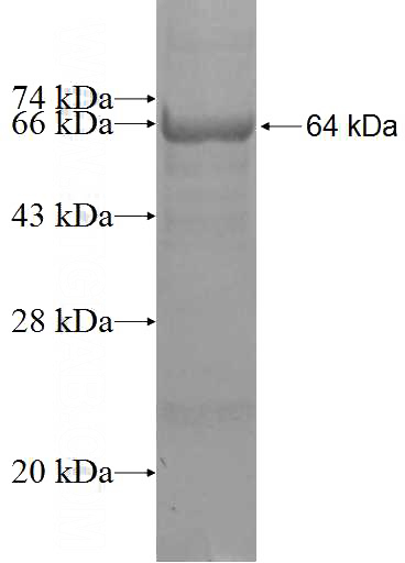 Recombinant Human CRTAC1 SDS-PAGE
