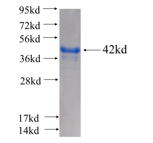 Recombinant human RPS6KB2 SDS-PAGE