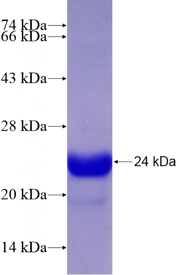 Recombinant Human PDE5A SDS-PAGE