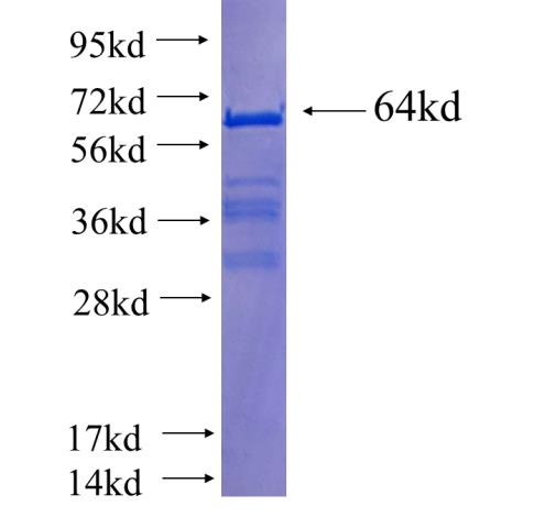 Recombinant human RXRA SDS-PAGE