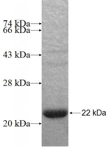 Recombinant Human SRP19 SDS-PAGE