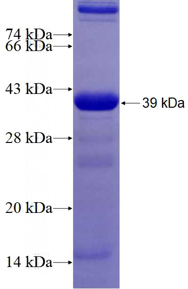 Recombinant Human M6PRBP1 SDS-PAGE