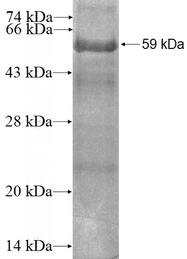 Recombinant Human GNB3 SDS-PAGE