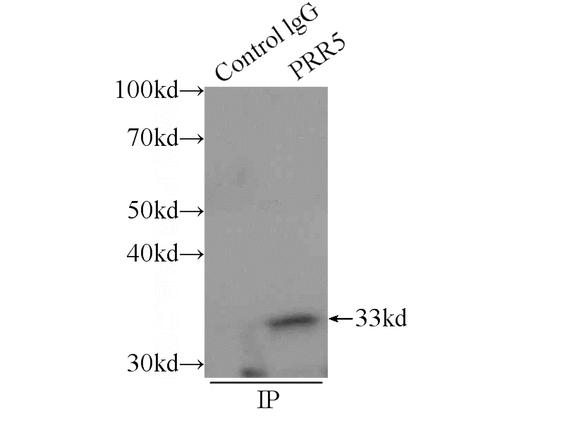 IP Result of anti-PRR5 (IP:Catalog No:114276, 3ug; Detection:Catalog No:114276 1:300) with mouse brain tissue lysate 4000ug.