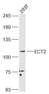 Fig1: Sample:; 293T(Human) Cell Lysate at 30 ug; Primary: Anti-ECT2 at 1/1000 dilution; Secondary: IRDye800CW Goat Anti-Rabbit IgG at 1/20000 dilution; Predicted band size: 100 kD; Observed band size: 108 kD