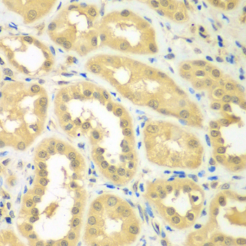 Immunohistochemistry - RPS6KL1 Polyclonal Antibody 