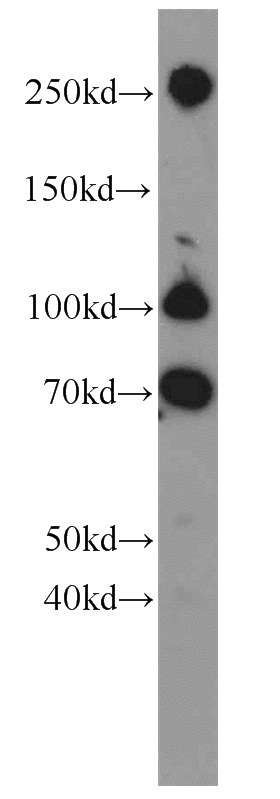 NIH/3T3 cells were subjected to SDS PAGE followed by western blot with Catalog No:110659(FN1 antibody) at dilution of 1:500