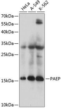 Western blot - PAEP Polyclonal Antibody 