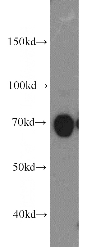 A431 cells were subjected to SDS PAGE followed by western blot with Catalog No:113849(PRKCD antibody) at dilution of 1:400