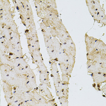 Immunohistochemistry - PPP2R5C Polyclonal Antibody 