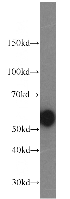 MCF7 cells were subjected to SDS PAGE followed by western blot with Catalog No:108888(CTSD antibody) at dilution of 1:1000