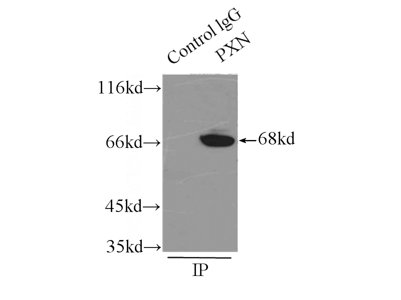 IP Result of anti-PXN (IP:Catalog No:113611, 3ug; Detection:Catalog No:113611 1:1000) with mouse brain tissue lysate 7500ug.
