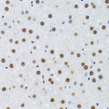 Immunohistochemistry - MTA3 Polyclonal Antibody 