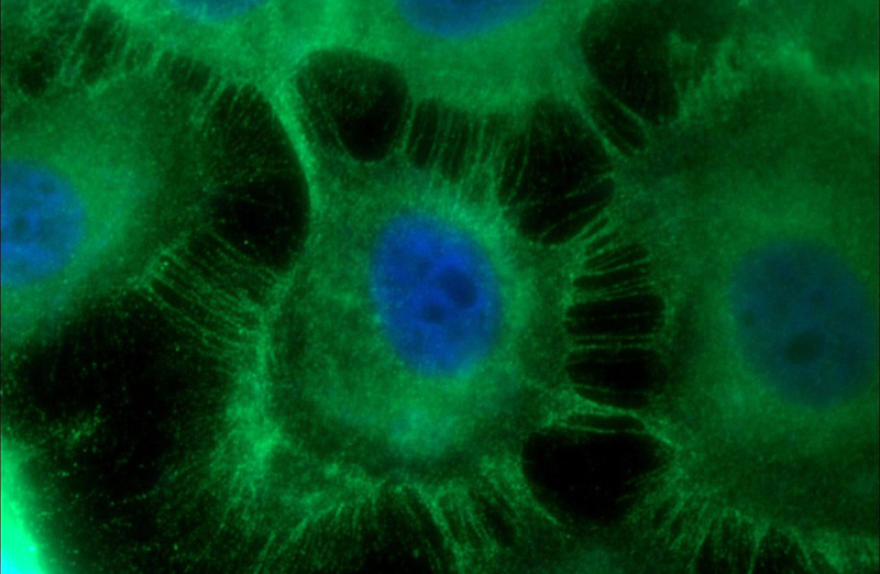 Immunofluorescent analysis of A431 cells using Catalog No:110288(E-cadherin Antibody) at dilution of 1:25 and Alexa Fluor 488-congugated AffiniPure Goat Anti-Rabbit IgG(H+L)