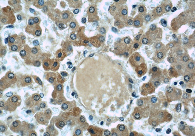 Immunohistochemical of paraffin-embedded human liver using Catalog No:107066(APOH antibody) at dilution of 1:50 (under 40x lens)