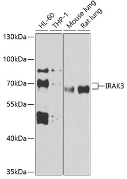 Western blot - IRAK3 Polyclonal Antibody 