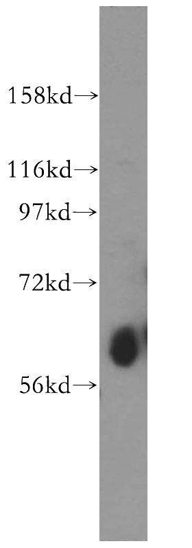 mouse lung tissue were subjected to SDS PAGE followed by western blot with Catalog No:117258(SLC30A7 antibody) at dilution of 1:500