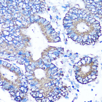 Immunohistochemistry - MMP16 Polyclonal Antibody 