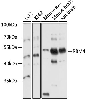 Western blot - RBM4 Polyclonal Antibody 