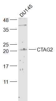 Fig1: Sample:; DU145(Human) Cell Lysate at 30 ug; Primary: Anti-CTAG2 at 1/300 dilution; Secondary: IRDye800CW Goat Anti-Rabbit IgG at 1/20000 dilution; Predicted band size: 23 kD; Observed band size: 21 kD