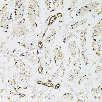 Immunohistochemistry - CD31 Polyclonal Antibody 