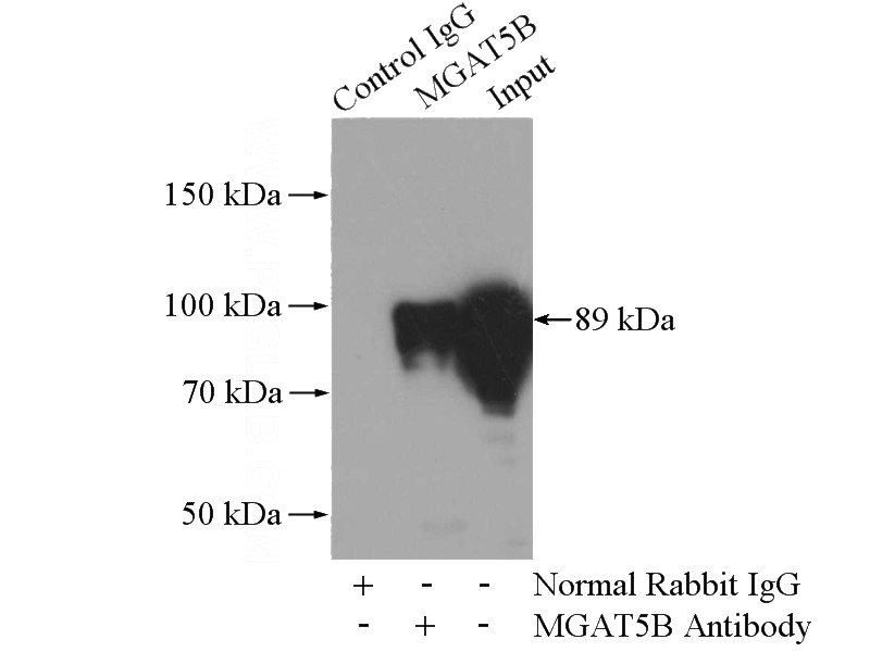 IP Result of anti-MGAT5B (IP:Catalog No:112596, 4ug; Detection:Catalog No:112596 1:700) with Jurkat cells lysate 3600ug.