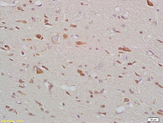 Fig1: Tissue/cell: rat brain tissue; 4% Paraformaldehyde-fixed and paraffin-embedded;; Antigen retrieval: citrate buffer ( 0.01M, pH 6.0 ), Boiling bathing for 15min; Block endogenous peroxidase by 3% Hydrogen peroxide for 30min; Blocking buffer (normal goat serum,C-0005) at 37℃ for 20 min;; Incubation: Anti-MTNR1B Polyclonal Antibody, Unconjugated 1:200, overnight at 4℃, followed by conjugation to the secondary antibody(SP-0023) and DAB(C-0010) staining