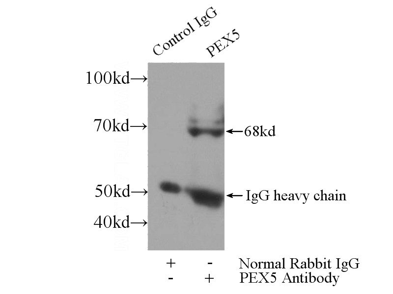 IP Result of anti-PEX5 (IP:Catalog No:113730, 4ug; Detection:Catalog No:113730 1:500) with mouse kidney tissue lysate 4000ug.