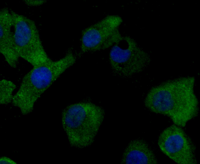 Fig1: ICC staining MMP17 in A549 cells (green). The nuclear counter stain is DAPI (blue). Cells were fixed in paraformaldehyde, permeabilised with 0.25% Triton X100/PBS.