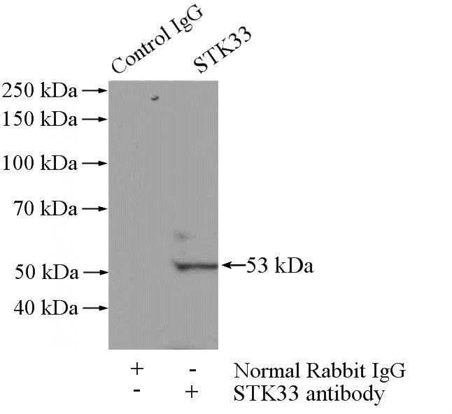 IP Result of anti-STK33 (IP:Catalog No:115720, 4ug; Detection:Catalog No:115720 1:300) with HEK-293 cells lysate 880ug.