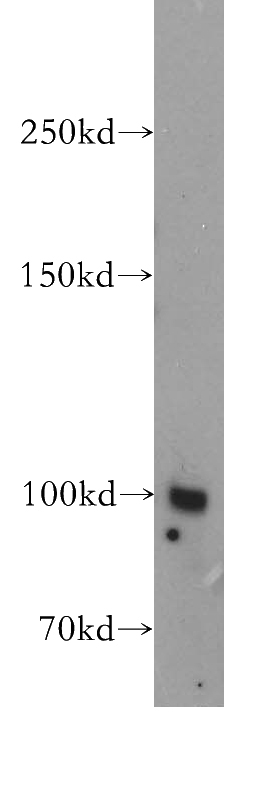 mouse kidney tissue were subjected to SDS PAGE followed by western blot with Catalog No:112695(MME,CD10 antibody) at dilution of 1:500