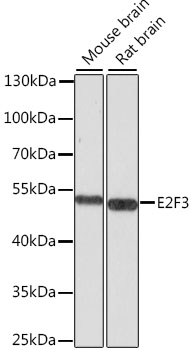 Western blot - E2F3 Polyclonal Antibody 