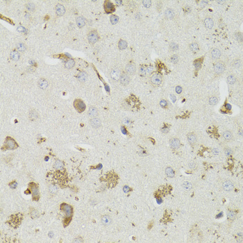 Immunohistochemistry - PTPN3 Polyclonal Antibody 