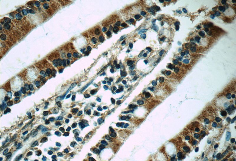 Immunohistochemistry of paraffin-embedded human small intestine tissue slide using Catalog No:112806(ABCC2 Antibody) at dilution of 1:50 (under 40x lens)