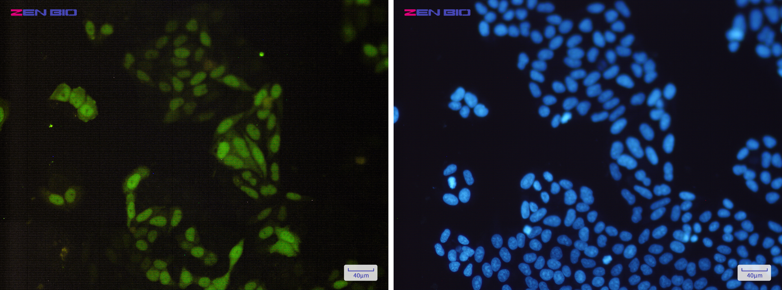 Immunocytochemistry of Cyclin A2(green) in Hela cells using Cyclin A2 Rabbit mAb at dilution 1/200, and DAPI(blue)